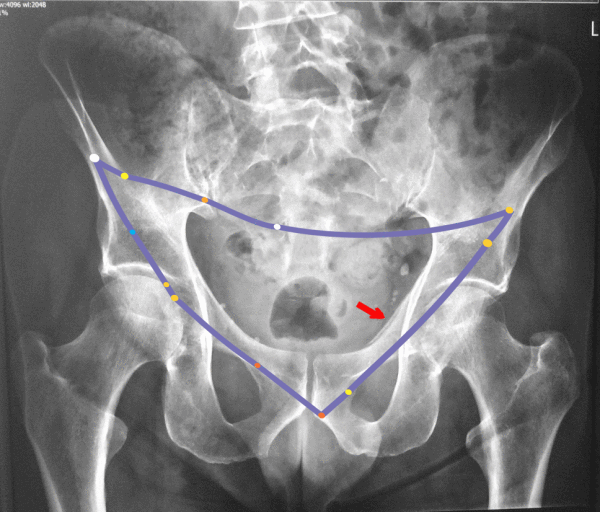 Pelvis constellation - Universal Workshop